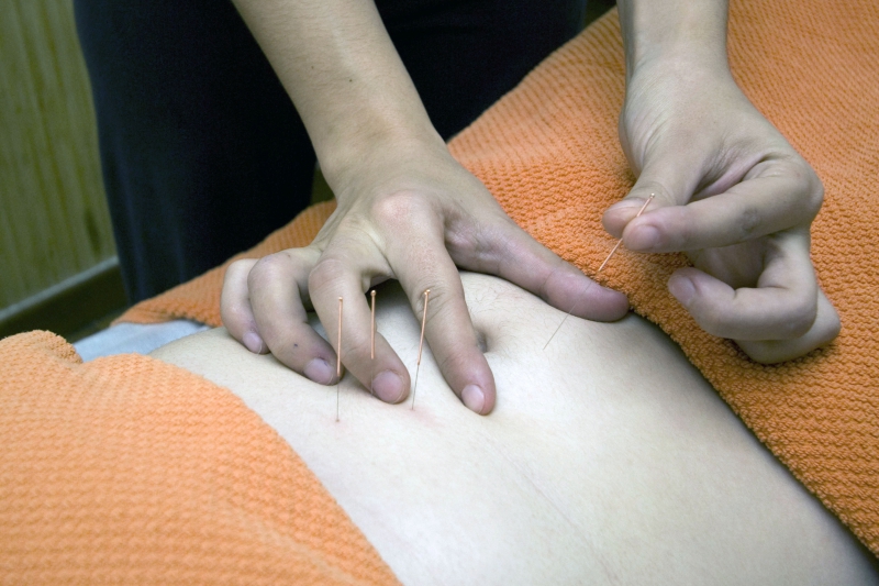 osteopathe-LA CADIERE D AZUR-min_acupuncture-4175625